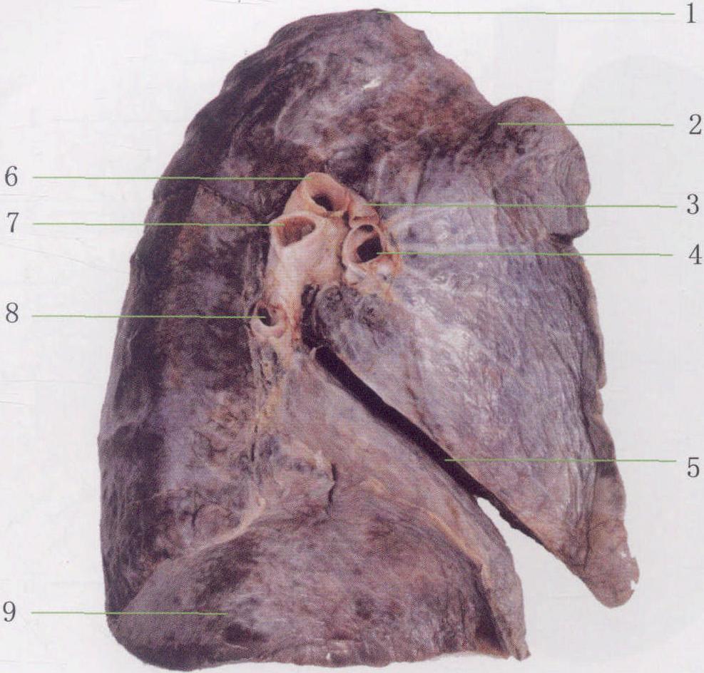 肺的内侧面图片